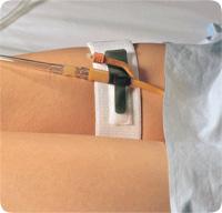 Foley Catheter Holder Leg Band – 2 in x 19.5 in
