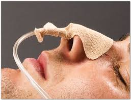 DAL 160 EA/1 DALE NASOGASTRIC TUBE HOLDER, ONE SIZE FITS MOST