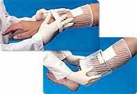 DUP GLNG704 EA/1 SURGILAST TUBULAR DRESSING RETAINER SIZE 4 LARGE: HAND. ARM, LEG, FOOT, 25YDS