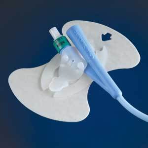 FCS 200XT EA/1 FOLEY ANCHOR URINARY CATH SECUREMENT