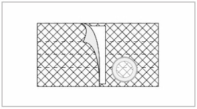 NUH 6443-P EA/1 NU-FORM COOL COMFORT 7IN, XLARGE, 2 3/8IN LEFT SIDE OPENING, W/PROLAPSE OVERBELT (NON-RETURNABLE)